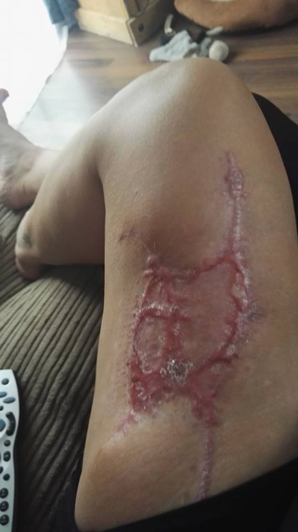 Sau một lần đập đầu vào lò vi sóng, gương mặt người mẹ xinh đẹp bỗng biến dạng khủng khiếp thế này - Ảnh 6. Sau một lần đập đầu vào lò vi sóng, gương mặt người mẹ xinh đẹp bỗng biến dạng khủng khiếp thế này - Ảnh 6.