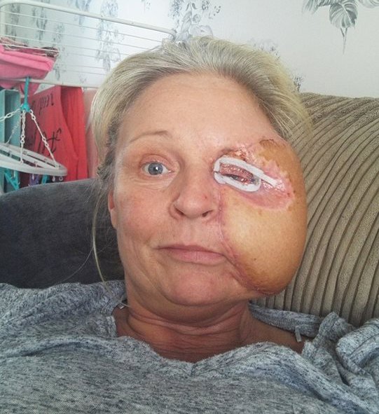 Sau một lần đập đầu vào lò vi sóng, gương mặt người mẹ xinh đẹp bỗng biến dạng khủng khiếp thế này - Ảnh 5. Sau một lần đập đầu vào lò vi sóng, gương mặt người mẹ xinh đẹp bỗng biến dạng khủng khiếp thế này - Ảnh 5.