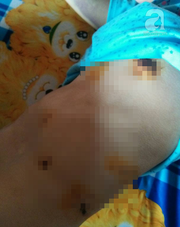 Người vợ trẻ bị bồ của chồng đánh ghen ngược: Nhìn con đòi mẹ mà bản thân bất lực không thể lại gần - Ảnh 1. Người vợ trẻ bị bồ của chồng đánh ghen ngược: Nhìn con đòi mẹ mà bản thân bất lực không thể lại gần - Ảnh 1.