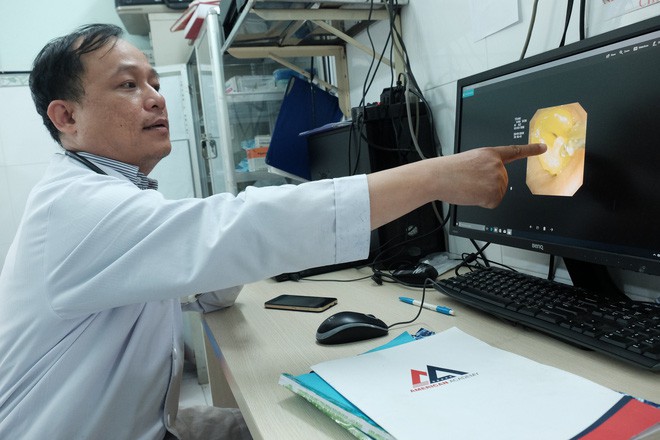 TP.HCM: Một người đàn ông hôn mê chỉ vì ăn mít ướt - Ảnh 2. TP.HCM: Một người đàn ông hôn mê chỉ vì ăn mít ướt - Ảnh 2.