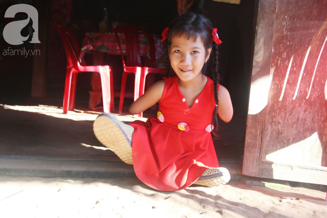 Không có tay chân nhưng cô bé chim cánh cụt 8 tuổi lúc nào cũng cười lạc quan khiến ai cũng rơi nước mắt - Ảnh 5. Không có tay chân nhưng cô bé chim cánh cụt 8 tuổi lúc nào cũng cười lạc quan khiến ai cũng rơi nước mắt - Ảnh 5.