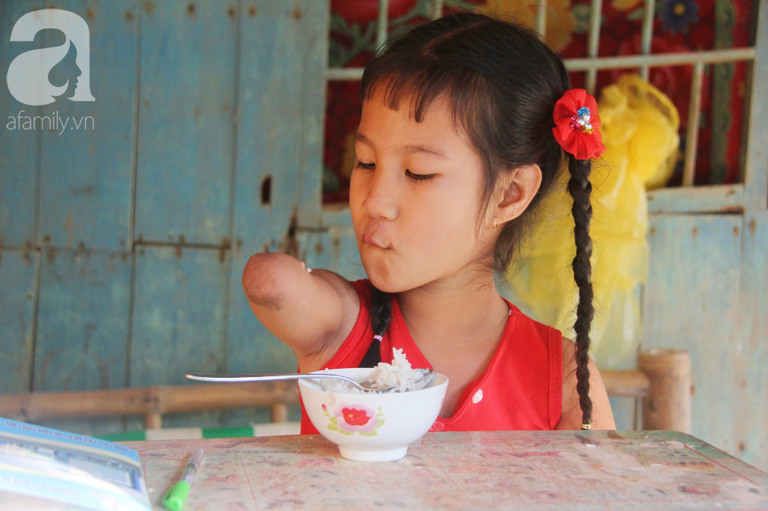 Không có tay chân nhưng cô bé chim cánh cụt 8 tuổi lúc nào cũng cười lạc quan khiến ai cũng rơi nước mắt - Ảnh 7. Không có tay chân nhưng cô bé chim cánh cụt 8 tuổi lúc nào cũng cười lạc quan khiến ai cũng rơi nước mắt - Ảnh 7.