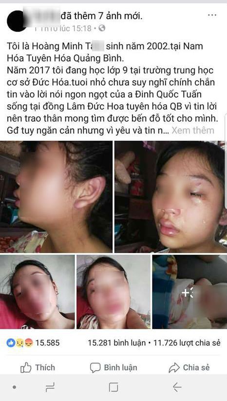 Mới sinh con hơn 1 tháng, vợ 16 tuổi lên mạng xã hội tố bị chồng bạo hành - Ảnh 1.