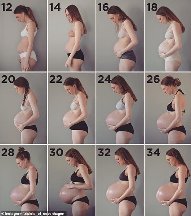 Bà mẹ sinh ba có bụng bầu dài bất thường lại gây sốt với vòng hai như chưa đẻ sau khi sinh 1 tháng - Ảnh 4.