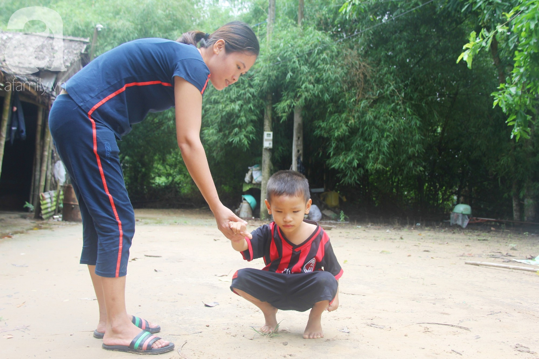 Phép màu đến với bé trai 4 tuổi mù một mắt, luôn hỏi mẹ ngây ngô: Con không thấy đường, mẹ có bỏ con không? - Ảnh 6.