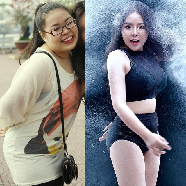 Phẫu thuật thẩm mỹ để đẹp hơn l&agrave; lựa chọn ri&ecirc;ng của mỗi người - Ảnh 2.
