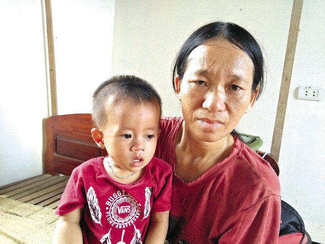 Mong manh ch&aacute;u b&eacute; vướng căn bệnh cả thế giới c&oacute; 9 ca mắc - Ảnh 1.