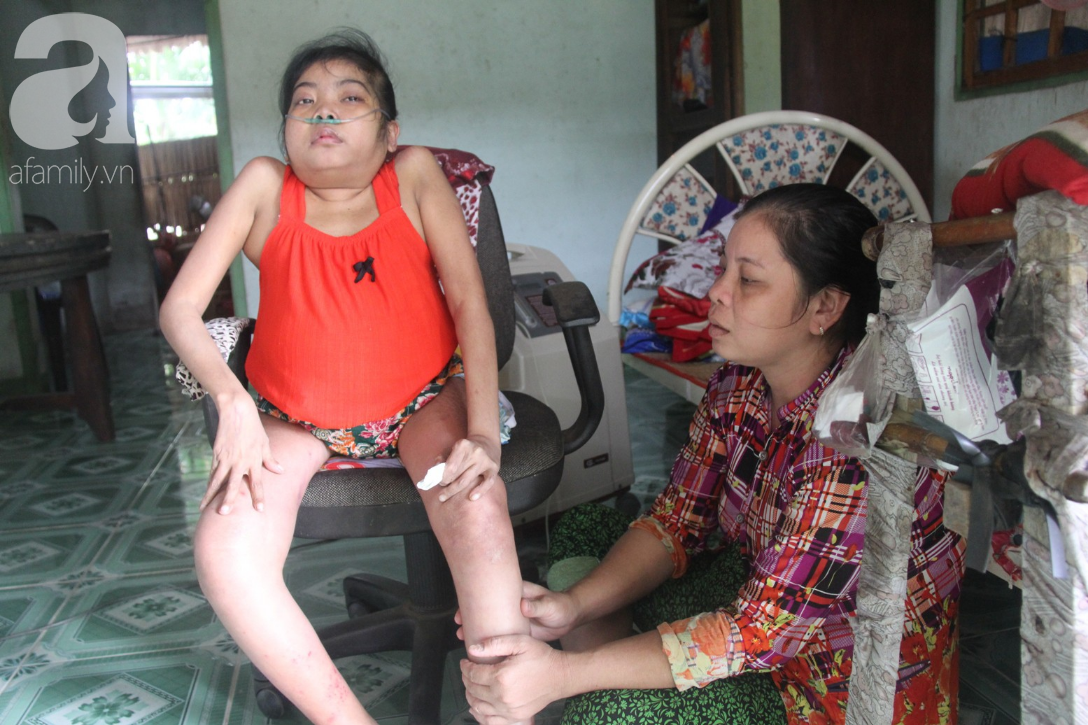 Phép màu đến với cô gái trẻ 12 năm ngủ ngồi, chỉ mong chết đi vì không muốn bố mẹ mượn nợ để em chữa bệnh - Ảnh 1. Phép màu đến với cô gái trẻ 12 năm ngủ ngồi, chỉ mong chết đi vì không muốn bố mẹ mượn nợ để em chữa bệnh - Ảnh 1.