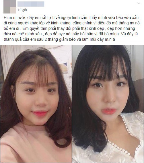 Mượn ảnh người khác để khoe nhan sắc sau phẫu thuật, cô gái nhận cái kết đắng khi bị vạch mặt giữa chốn đông người - Ảnh 1. Mượn ảnh người khác để khoe nhan sắc sau phẫu thuật, cô gái nhận cái kết đắng khi bị vạch mặt giữa chốn đông người - Ảnh 1.
