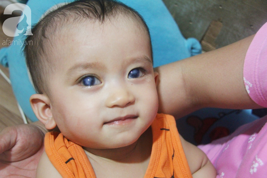 Điều kỳ diệu đến với Gia Anh, bé trai 14 tháng tuổi có đôi mắt màu xanh đi tìm ánh sáng - Ảnh 9.