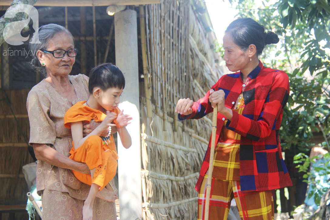 Bố bỏ từ trong bụng mẹ, bé gái 5 tuổi bại não sống cùng người mẹ tật nguyền cầu xin một lần được chữa bệnh - Ảnh 8.