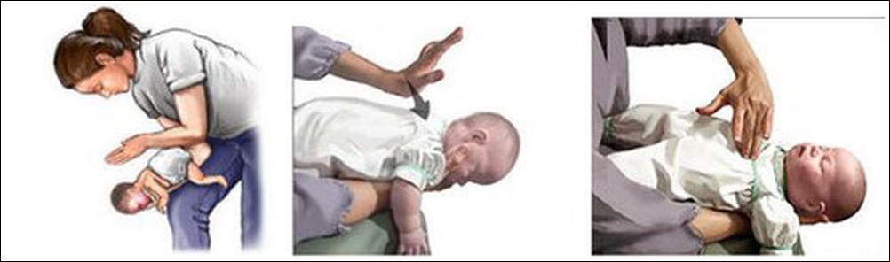 3 phút địa ngục suýt mất con vì chiếc kẹo mút, bà mẹ cảnh báo về thứ nhỏ bé cha mẹ không thể coi thường - Ảnh 4. 3 phút địa ngục suýt mất con vì chiếc kẹo mút, bà mẹ cảnh báo về thứ nhỏ bé cha mẹ không thể coi thường - Ảnh 4.