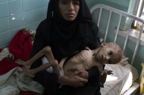 Ám ảnh nạn đói tại Yemen: 85.000 trẻ em tử vong vì thiếu dinh dưỡng - Ảnh 2.