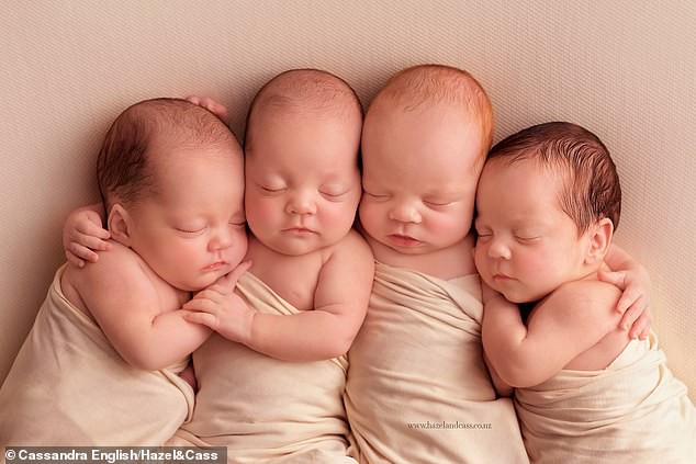 Ngắm 4 em bé đẹp tựa thiên thần trong ca sinh tư chào đời ở tuần thai thứ 29 - Ảnh 1.