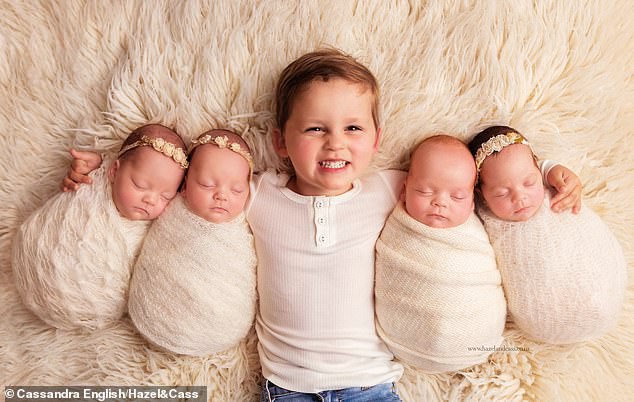 Ngắm 4 em bé đẹp tựa thiên thần trong ca sinh tư chào đời ở tuần thai thứ 29 - Ảnh 5.
