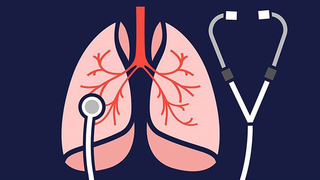 Những việc cực đơn giản nhưng nên làm vì vô cùng có lợi cho phổi, góp phần ngăn ngừa ung thư phổi - Ảnh 4.