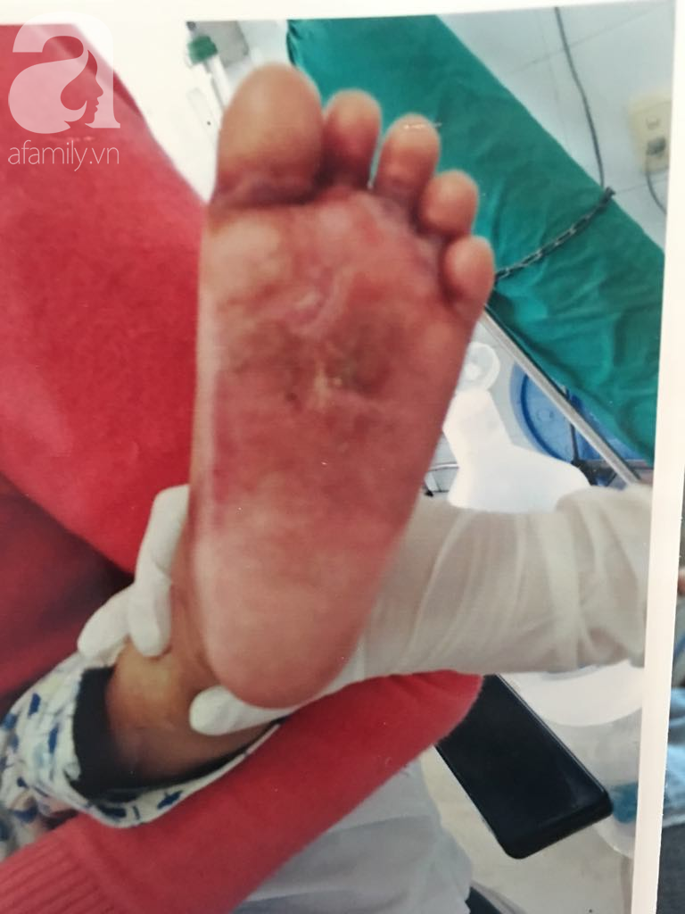 TP.HCM: Bé gái 18 tháng tuổi bị phỏng bất thường ở chân khi đi học ở trường mầm non, bố mẹ làm đơn cầu cứu - Ảnh 2.