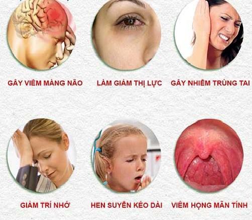 Cảnh báo: Viêm mũi xoang nguy hiểm khôn lường - Ảnh 1.