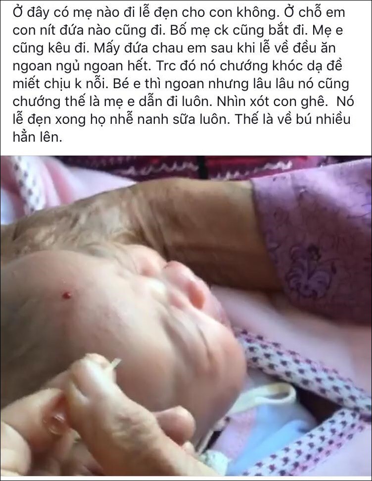 Bác sĩ nói gì về việc dùng kim châm vào đầu trẻ sơ sinh cho chảy máu để con ăn khỏe, nhanh lớn - Ảnh 1. Bác sĩ nói gì về việc dùng kim châm vào đầu trẻ sơ sinh cho chảy máu để con ăn khỏe, nhanh lớn - Ảnh 1.