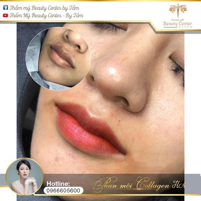Beauty Center by Tấm, địa chỉ phun thêu điêu khắc lông mày đẹp và uy tín - Ảnh 5. Beauty Center by Tấm, địa chỉ phun thêu điêu khắc lông mày đẹp và uy tín - Ảnh 5.