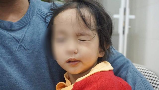Rét đậm khắc nghiệt, nhiều trẻ liệt mặt, méo miệng vì nhiễm lạnh đột ngột - Ảnh 2. Rét đậm khắc nghiệt, nhiều trẻ liệt mặt, méo miệng vì nhiễm lạnh đột ngột - Ảnh 2.