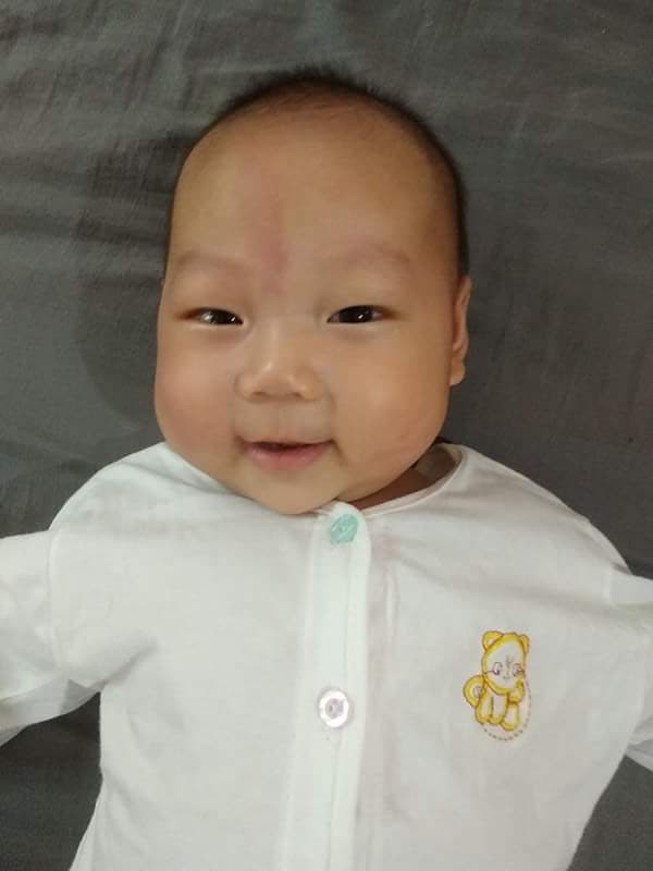 Hành trình giữ con kì diệu của mẹ Hà Nội khi thai nhi bị tràn dịch màng phổi, màng bụng và phù thai - Ảnh 5.