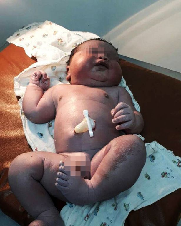Những bé sơ sinh vừa chào đời đã sở hữu cân nặng kỷ lục bằng trẻ nuôi vài tháng - Ảnh 1.
