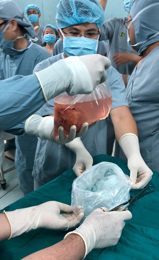 Mẹ quyết sinh con ra để lấy tạng cho người kh&aacute;c - Ảnh 1.