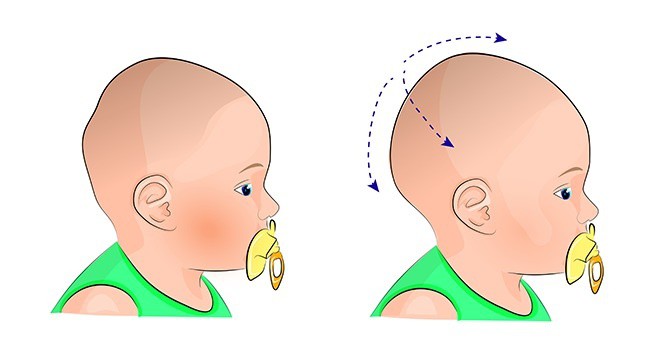 7 dấu hiệu bất thường ở trẻ sơ sinh, bố mẹ đừng chần chừ mà hãy đưa bé đi khám ngay  - Ảnh 4.