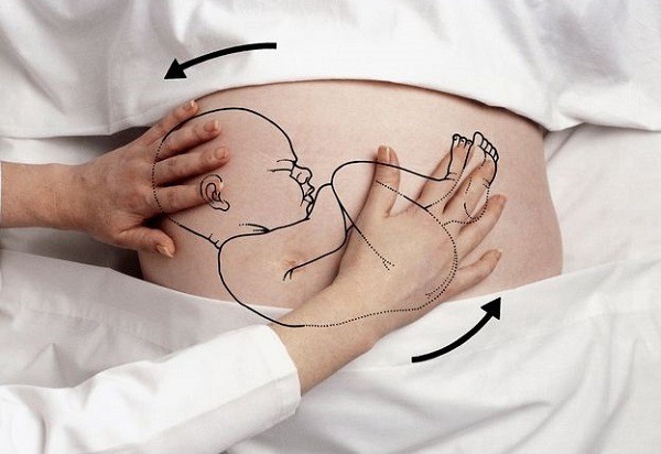 Tròn mắt xem bác sĩ dùng 2 tay xoay ngôi thai từ ngôi ngược thành ngôi thuận chỉ trong chưa đầy 1 phút - Ảnh 8.