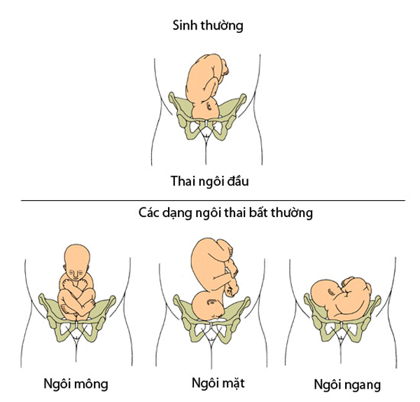 Tròn mắt xem bác sĩ dùng 2 tay xoay ngôi thai từ ngôi ngược thành ngôi thuận chỉ trong chưa đầy 1 phút - Ảnh 7.