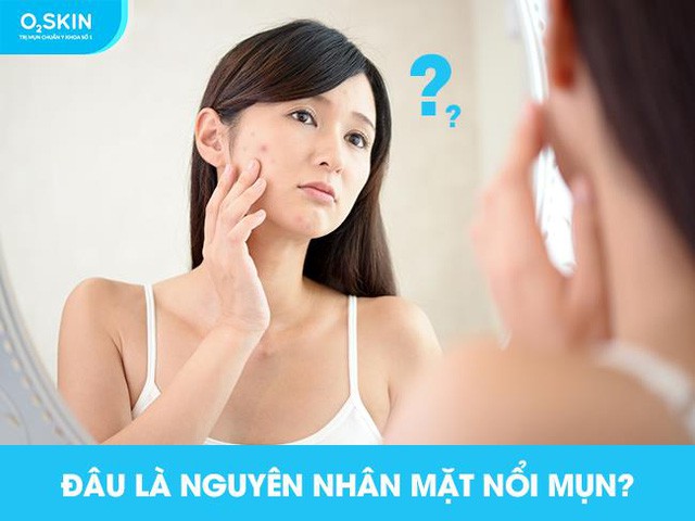 Gian nan hành trình điều trị mụn - Ảnh 2.