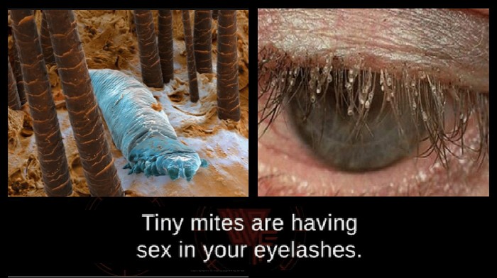 Lông mi, thậm chí cả khuôn mặt của bạn thực ra vô cùng bẩn vì lúc nào cũng có những con bọ này làm tổ - Ảnh 4. Lông mi, thậm chí cả khuôn mặt của bạn thực ra vô cùng bẩn vì lúc nào cũng có những con bọ này làm tổ - Ảnh 4.