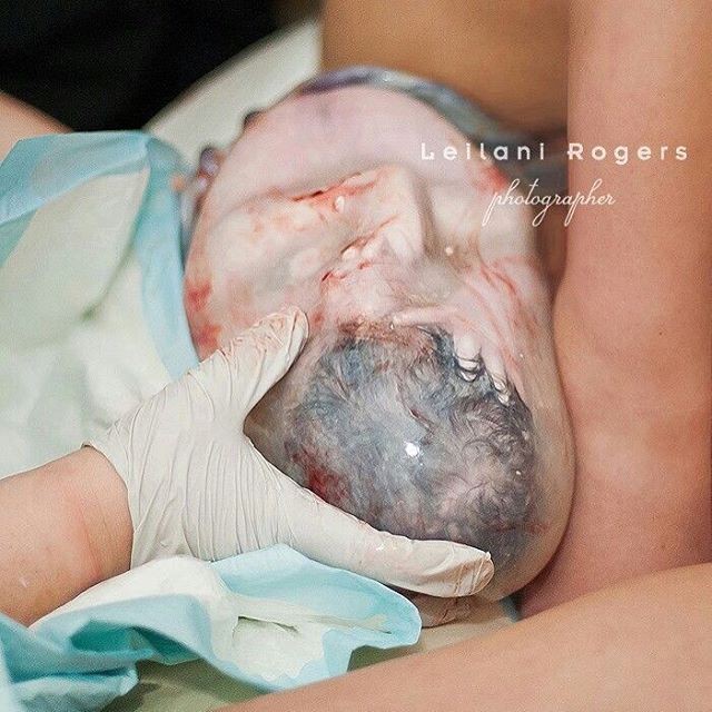 Những bức ảnh sinh nở cực hiếm khi em bé chào đời còn nguyên trong túi ối - Ảnh 13.