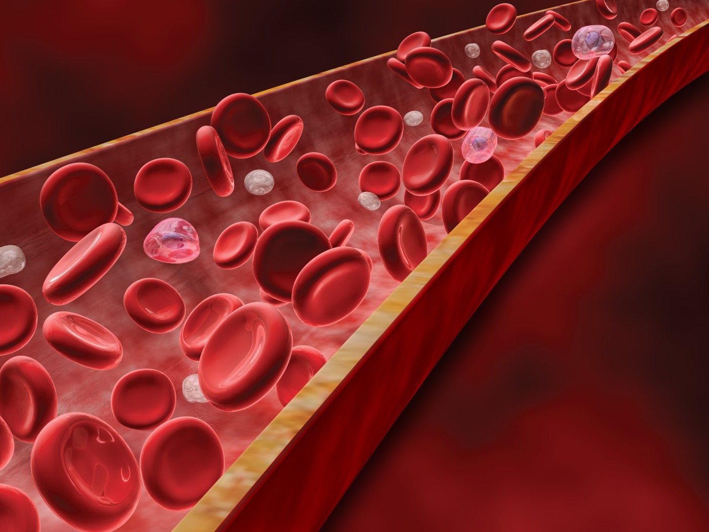 Холестерин плазмы крови. Клетки крови в сосуде. Эритроциты в сосуде. Патологии кроветворения.