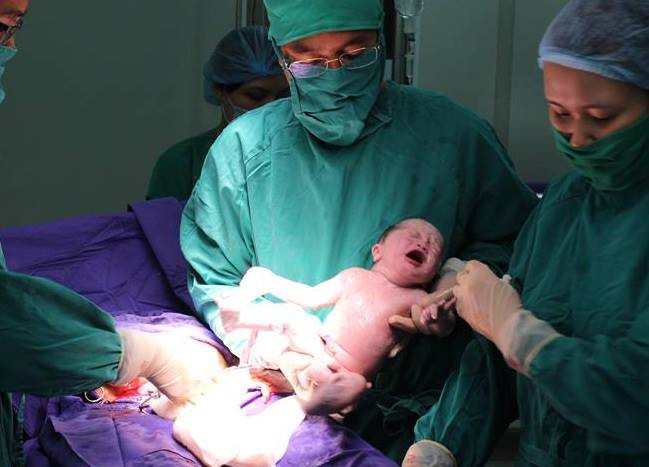 Hai bé trai được sinh cùng trứng từ thụ tinh nhân tạo tại BV Quảng Ninh - Ảnh 1.