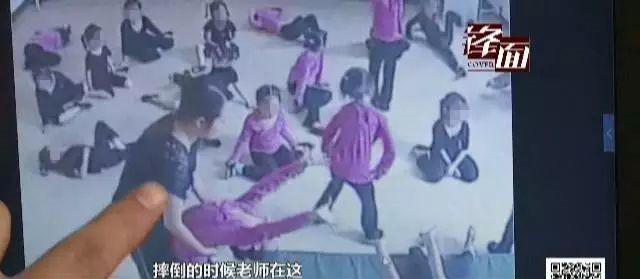 Bị ngã khi tập động tác uốn dẻo trong lớp múa, bé gái 4 tuổi bại liệt do tổn thương tủy sống - Ảnh 2.