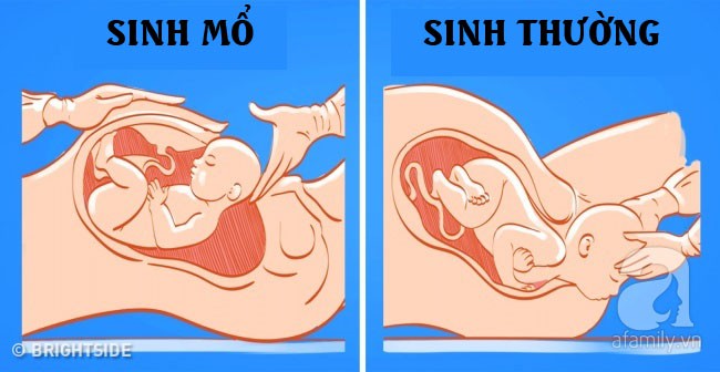 Những quan niệm sai lầm về mang thai và sinh nở dễ khiến mẹ bầu hoang mang - Ảnh 11.