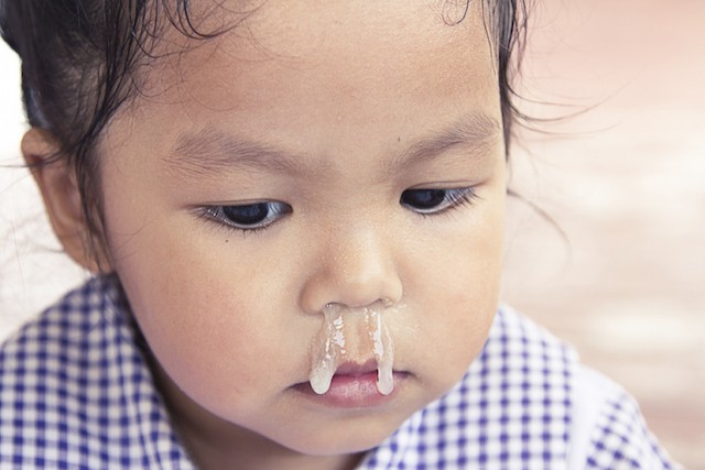 Các bác sĩ cảnh báo về cách chữa sổ mũi bằng tỏi ngâm nước muối sinh lý đang được các mẹ lan truyền - Ảnh 2.