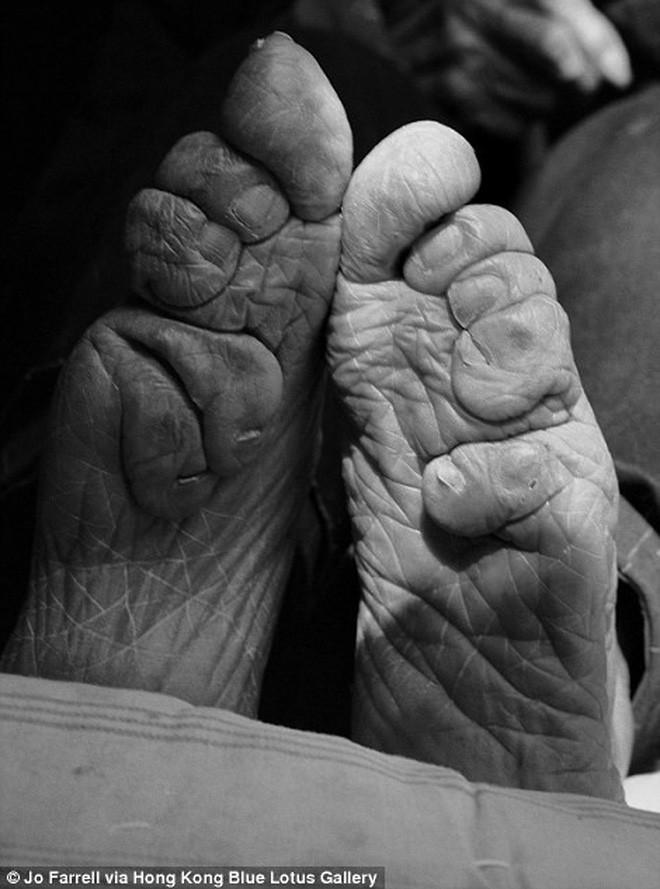 Những đôi chân gót sen cuối cùng tại Trung Quốc: Khi sắc đẹp là nỗi đau suốt đời của người phụ nữ - Ảnh 14.