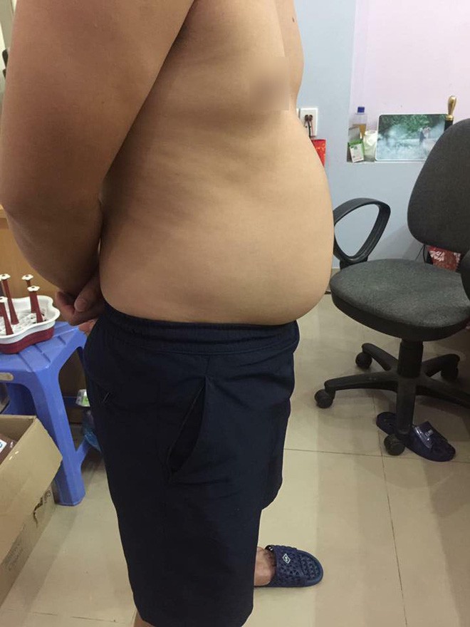 Chàng trai tăng 10kg sau khi kết hôn, bụng to cạnh tranh với vợ bầu 32 tuần - Ảnh 2.