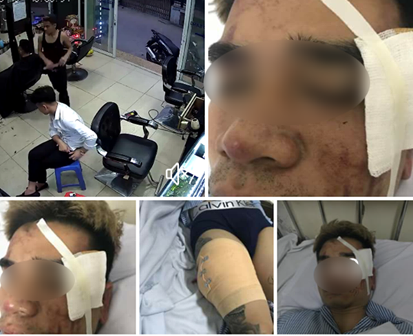 Hà Nội: Kinh hãi kẻ tình nghi bịt mặt xông vào quán cắt tóc tấn công nhân viên  - Ảnh 1.