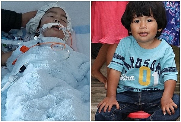 Con trai 2 tuổi nhập viện khẩn cấp vì ho, sau khi chụp hình X-quang bác sĩ phát hiện sự thật kinh khủng khiến họ phải “bó tay” - Ảnh 2.