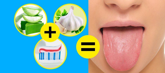 Nhận biết bệnh qua từng vùng lưỡi màu trắng và 5 cách đơn giản giúp lưỡi khỏe mạnh, hết vi khuẩn - Ảnh 1.