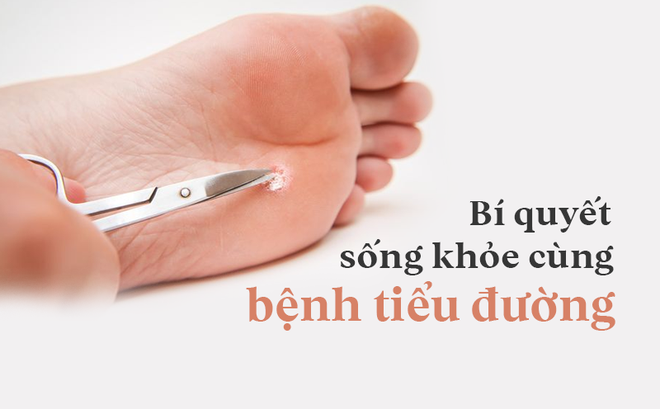 Người bị tiểu đường có thể thảnh thơi sống khỏe đến già nếu áp dụng công thức 69834 - Ảnh 1.