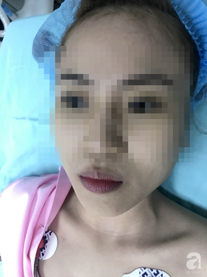 Cô gái 22 tuổi ở Bạc Liêu bị hủy hoại dung nhan vì đi nâng mũi bằng chỉ - Ảnh 5.
