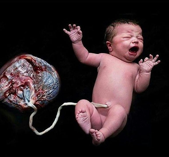 Mẹ bầu ở Hưng Yên gây sốc khi sinh con tại nhà, tự đỡ đẻ và để nhau thai gắn với bé đến 6 ngày sau sinh - Ảnh 3.