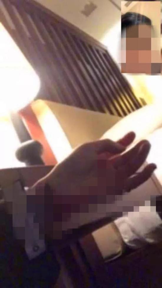 Đau khổ vì chia tay với bạn trai, cô gái trẻ livestream cắt cổ tay tự tử - Ảnh 1. Đau khổ vì chia tay với bạn trai, cô gái trẻ livestream cắt cổ tay tự tử - Ảnh 1.