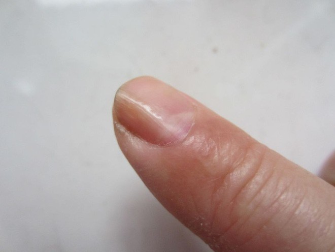 Nếu gan sinh bệnh hoặc nhiễm độc, móng tay sẽ có 3 thay đổi bất thường dễ nhận biết - Ảnh 1.