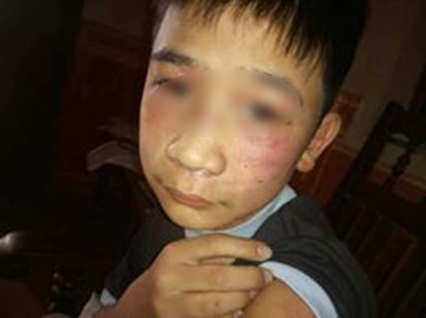 Vụ bé trai 14 tuổi bị bạo hành: Bác ruột từng chứng kiến trận đòn của bố dành cho con nhưng bất lực - Ảnh 2.